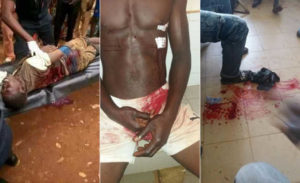 Togo : Mango et Bafilo, Deux villes sous les balles réelles de Faure Gnassingbé.