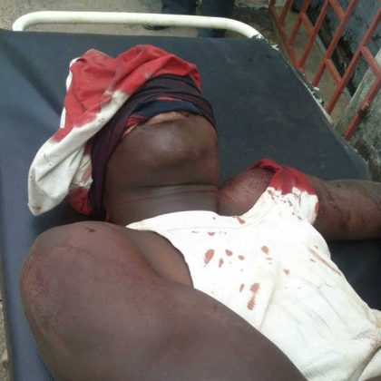 Togo :  Violences après l&rsquo;enlèvement d&rsquo;un imam par la soldatesque de Faure Gnassingbé . Au moins 3 morts et une vingtaine de blessés