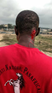 Marche du PNP : Tirs de grenades lacrymogènes et dispersion des premiers manifestants