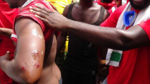Togo, Retour sur la répression sanglante de la manif du PNP le week-end dernier : Des morts. Des blessés. Des disparus. Des arrestations. Des emprisonnements. Et l&rsquo;arrogant taliban Yark Damehane non repentant.