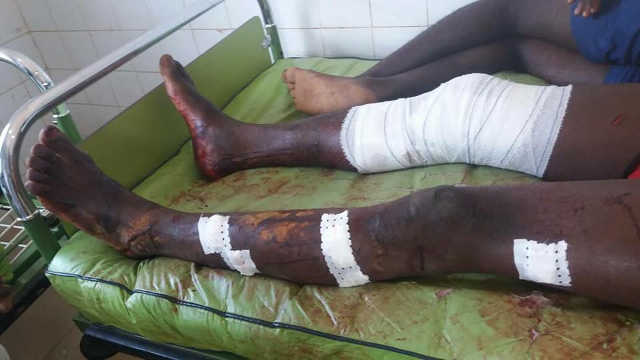 Togo, Barbarie militaire à Bafilo : 4 jeunes arrêtés, passés à tabac, détenus sans soins à la prison civile de Kara