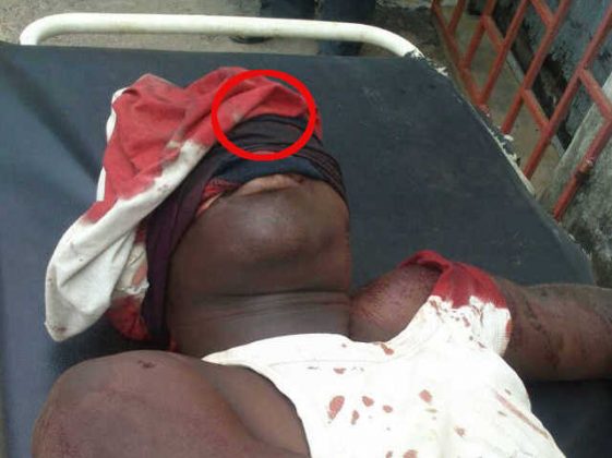 Togo : Le régime infanticide Faure/RPT/UNIR.