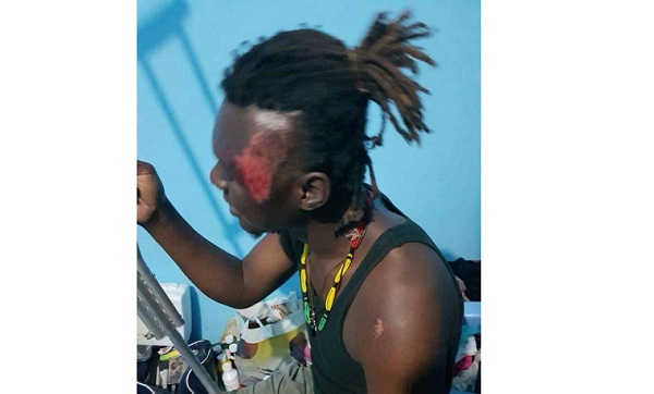 Attaque du convoi de musiciens par des militaires : Ras Sankara s’en sort avec des blessures graves                                                                             10 novembre 2017