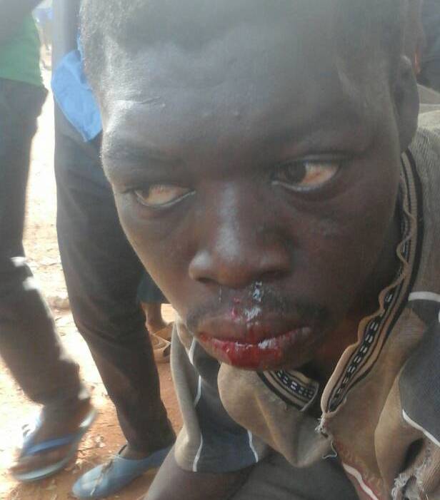 Togo/Manifestations de l&rsquo;opposition : Les premiers blessés déjà enregistrés à Sokodé ! &#8211; Images