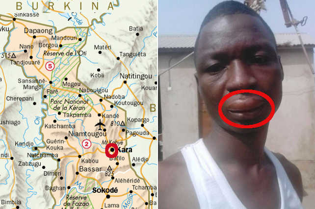 Togo, Violence et Impunité : Kara, la ville otage des miliciens du RPT-UNIR…