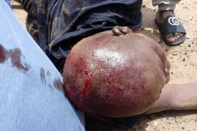 Togo, 3e jour des Manifs : 4e jour de Répression Sauvage. Et un doigt d’honneur de Faure Gnassingbé aux «durs» de la CEDEAO ?!