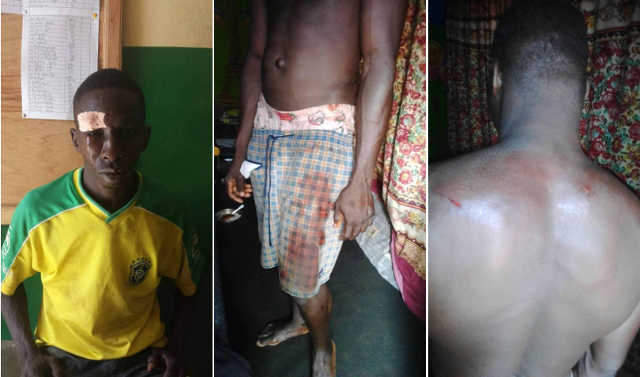 Togo : Nouvelles violences du régime Faure/RPT-UNIR face aux manifestations pacifiques. Des blessés enregistrés.