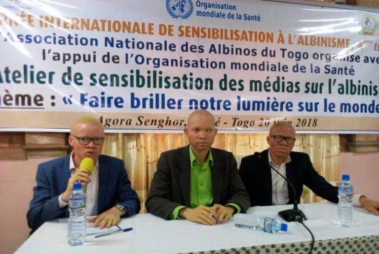 Les médias mis à contribution pour « faire briller la lumière » des Albinos au Togo