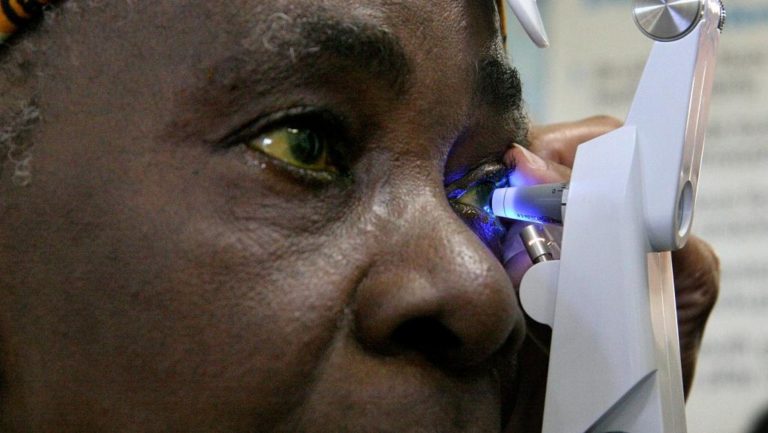 Togo / 200 patients ont été opérés de la cataracte cette semaine dans le Kpendjal