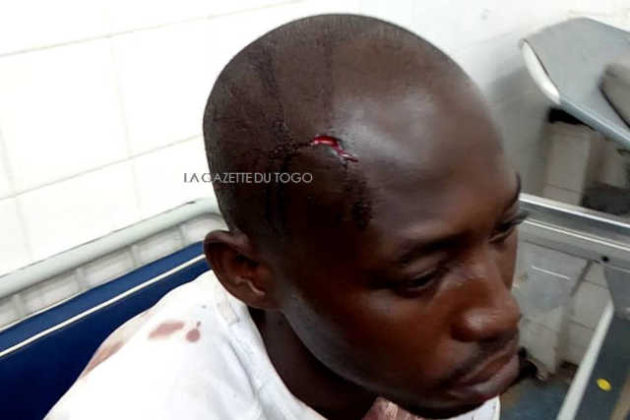 Togo, Impunité : Un élève gendarme abat 2 personnes et blesse plusieurs autres à Lomé.