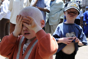 Burundi: découverte du corps démembré d’un jeune albinos