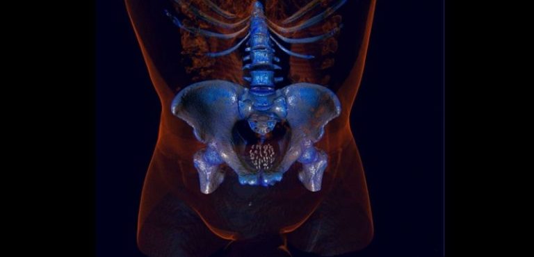 Cancer de la prostate : ce qu’il faut savoir sur le rôle préventif de l’éjaculation