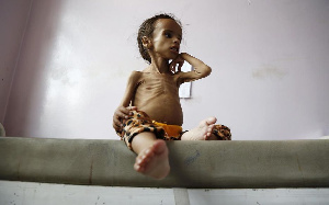 Plus de 5 millions d’enfants entrain de mourir au Yemen