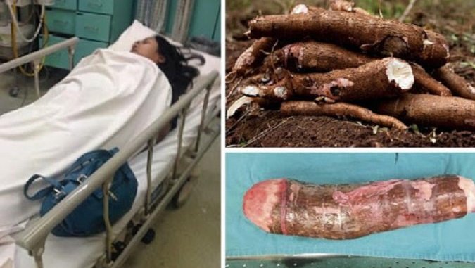 Une femme hospitalisée après s’être masturbée avec du manioc