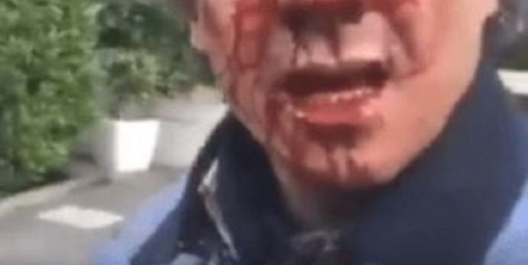 Un Malien a cassé le nez d’un policier marocain qui l’aurait traité de singe