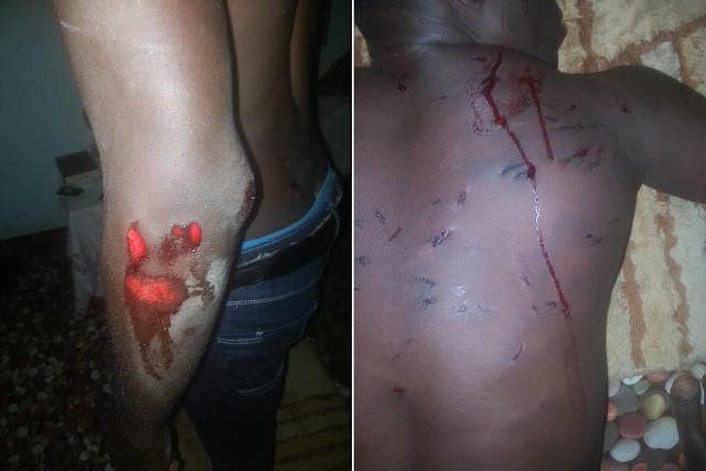 Violence gratuite et Impunité au Togo : Deux étudiants sauvagement battus à Kara