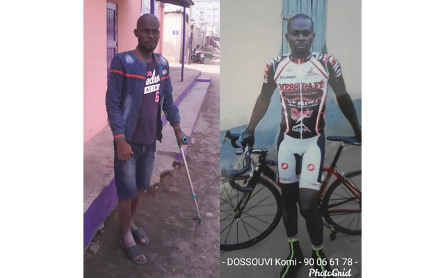 Komi Dossouvi, un ancien cycliste malade qui demande de l’aide