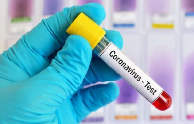 Gestion des cas de coronavirus au Togo : Le plus dur reste à venir