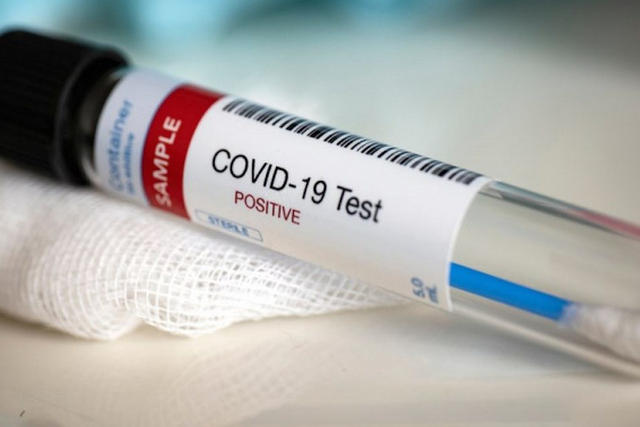 Togo, Covid-19 : Le Test de coronavirus payant, une décision dangereuse !