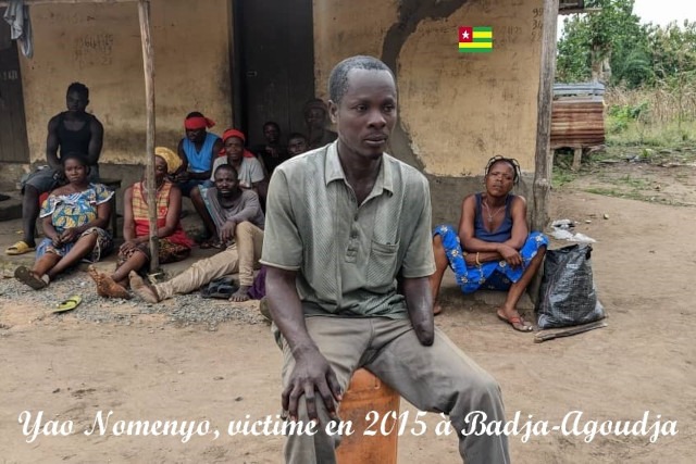 Togo / Violences à Badja-Agoudja : Mutilé en 2015, un cultivateur échappe de nouveau à la mort